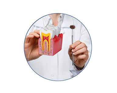 RootCanal
