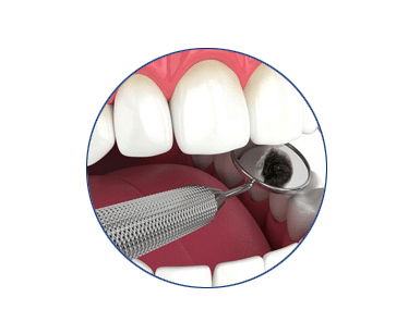 hindi-hindu-indian-dentist-carrollwood-wesley-chapel