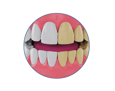 indian-dentist-cosmetic-carrollwood-wesley-chapel